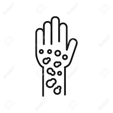 Psoriasis