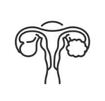 PCOS